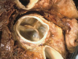 Tricuspid Valve of Heart an Atrioventricular Valve Photographic Print
