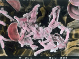 Fibrin Strands Red Blood Cell, X5,200 Photographic Print