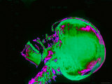 X-Ray Normal Human Skull Head Face Brain Neurology Photographie