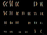 Normal Female Child Karyotype Color Photographic Print