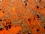 Endometrium with Decidua X40 Photomicrograph Photographic Print