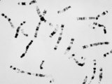 Human Chromosomes, Free Showing Banding Photographic Print