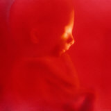 Human Fetus 10-15 Weeks Fetus 1st Trimester Photographic Print