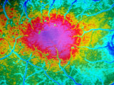 Ophthalmic Fundus Fotografie-Druck