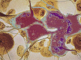 Digitized Nerve Cells Impulse Lost Photographic Print