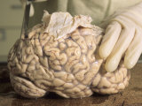 Hospital Morgue Preparing Brain for Autopsy Photographic Print