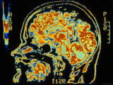 Digitized MRI Sagittal, Human Head Photographic Print