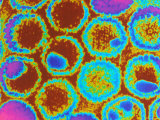 Herpes Simplex Viruses Color Em Photographie