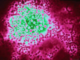Hepatitis B Virus Photographic Print