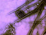 Astrovirus from Stool Diarrhea Virus Intestinal Photographic Print