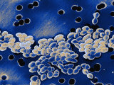 Vancomycin Resistant Enterococci Photographic Print