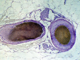 Normal Artery Vein and Capillary Micrograph X100 Photographic Print