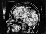 Sagittal Section, MRI Human Head Photographic Print