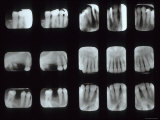 15 Dental X-Rays Fotografie-Druck