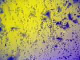 Household Mold Photomicrograph X100 Lámina fotográfica Household Mold Photomicrograph X100 Lámina fotográfica