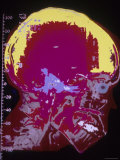 Head and Neck Anatomy Lateral X-Ray Colorized Photographic Print