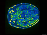 Computer Aided Tomography Imaging Plane Brain Ct Photographic Print
