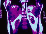MRI of Abdomen, Median Plane Photographic Print