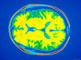 Normal Cat Scan Computed Aided Tomography Photographic Print