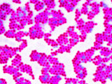 MRSA Infections Occur Most Frequently in Hospitals and Healthcare Photographic Print