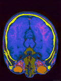 Brain Hemispheres Visible Colorized MRI Normal Photographic Print