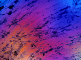 Dental Plaque Plaque X400 Photographic Print