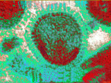 Avian Influenza, an Infectious Disease of Birds Caused by Type a Strain of Influenza Virus Photographic Print