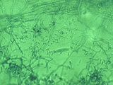 Trichophyton Rubrum Macro and Microconidia Photographic Print