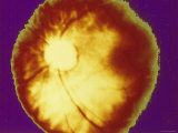 Ophthalmic Image of Retina Normal Photographic Print