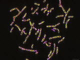 Human Chromosomes Photographic Print