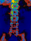 Digitized Radiograph Spine Pelvis X-Ray Fotografie-Druck