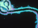 Ebola Virus Micrograph Enhansed Photographie