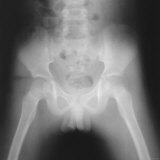 X Ray Normal Pelvis of 7 Y O Boy Photographic Print