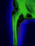 Leg Bone Colorized Xray Abdomen Pelvis Femur Joint Lámina fotográfica