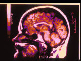 Magnetic Resonance Imaging Lateral View of Head Photographic Print