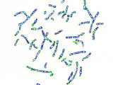 Human Chromosomes Changed to Z087-N-761 Photographic Print