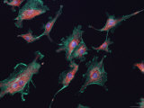 Mammalian Nerve Cells Dendrite Sensory Synapse Photographic Print