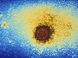 Rhinovirus Common Cold Type 1A Mag X100000 Photographic Print