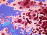 Pap Smear Cervical Cells Fotografie-Druck