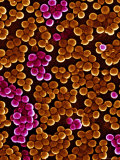 MRSA Infections Occur Most Frequently in Hospitals and Healthcare Photographie