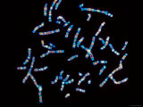 Human Chromosomes Photographie