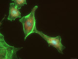 Neurons Human Brain Cognition Synapse Photographie