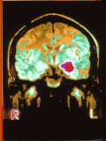 Magnetic Resonance Imaging MRI of Head Photographic Print