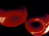 Two Red Blood Cells False Color Sem Photographie