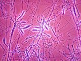 Avian Flu Photomicrograph Microsporum Gallinae Fowl Photographic Print