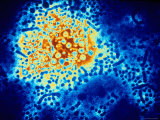 Hepatitis B Virus Electron Micrograph Tem Photographic Print