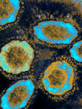 Sars Coronavirus Composite Severe Acute Respiratory Fotografie-Druck