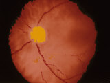 Ophthalmic Image of Retina Normal Photographic Print