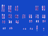 Normal Male Karyotype Paired Chromosomes Lámina fotográfica Normal Male Karyotype Paired Chromosomes Lámina fotográfica