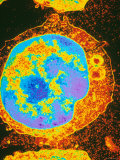 Lymphocyte from Peripheral Blood Tem X10,000 Enhanced Photographic Print